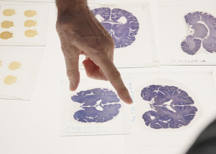 Finger pointing at brain slice images